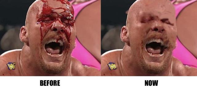 WWE digitally erases all blood from video archive