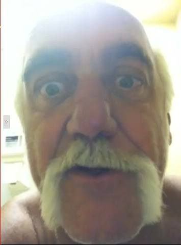 Hogan apologizes for gory burn photos, but stands behind poop video