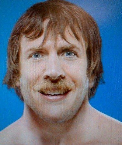 Neck surgery forces Bryan to vacate beard