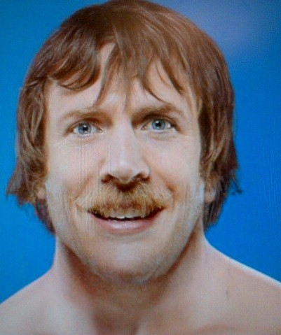 Neck surgery forces Bryan to vacate beard