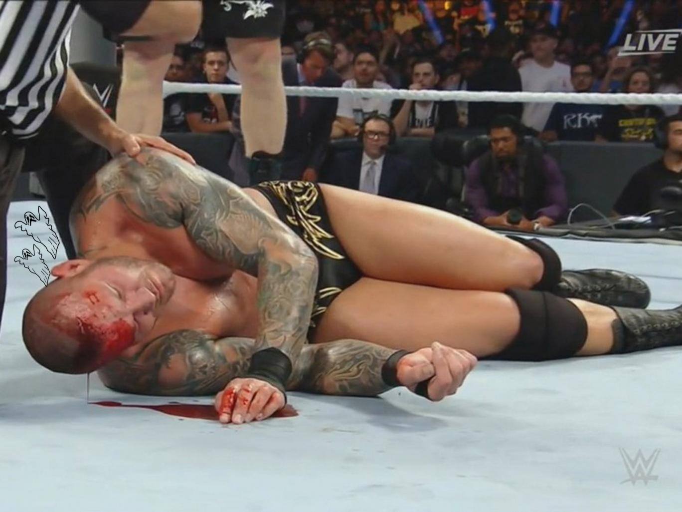 Voices in Orton’s head escape through gash