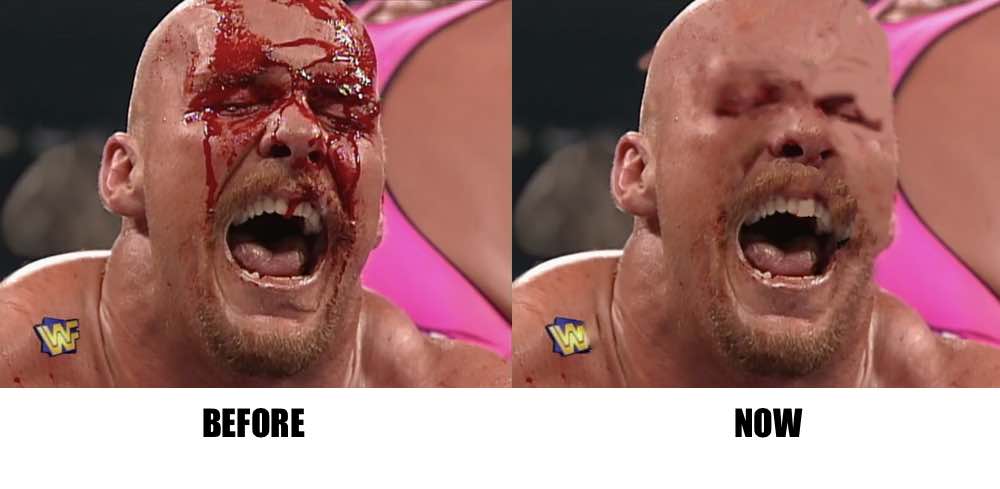 WWE digitally erases all blood from video archive