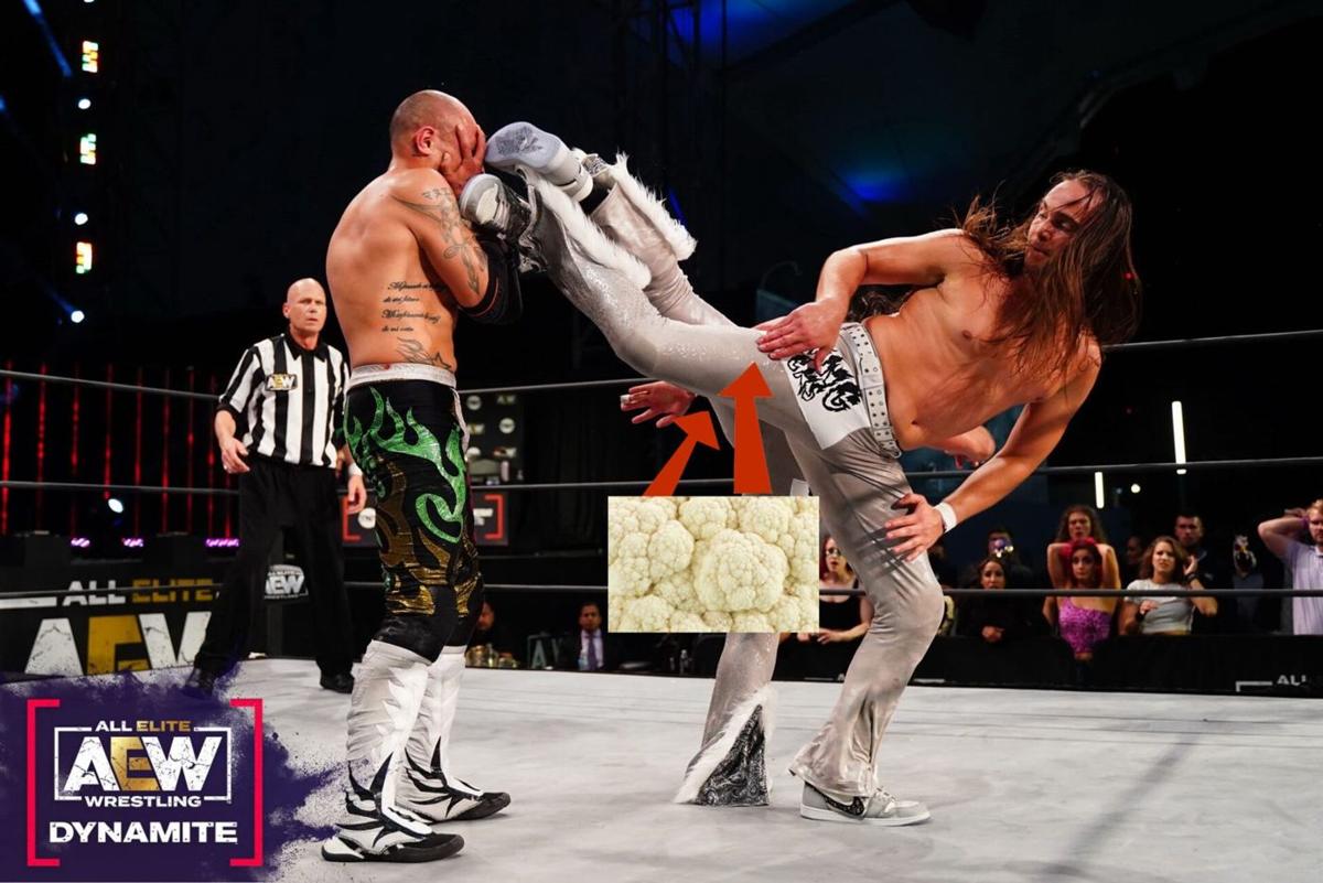 Young Bucks hospitalized with cauliflower thigh